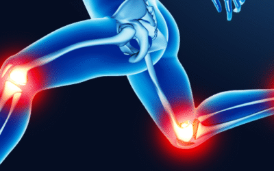 Joint Health – nutritional support